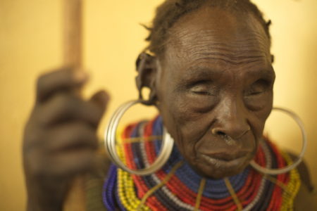 trachoma